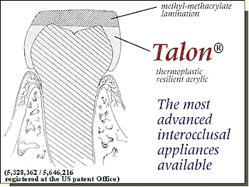 Talon Splints