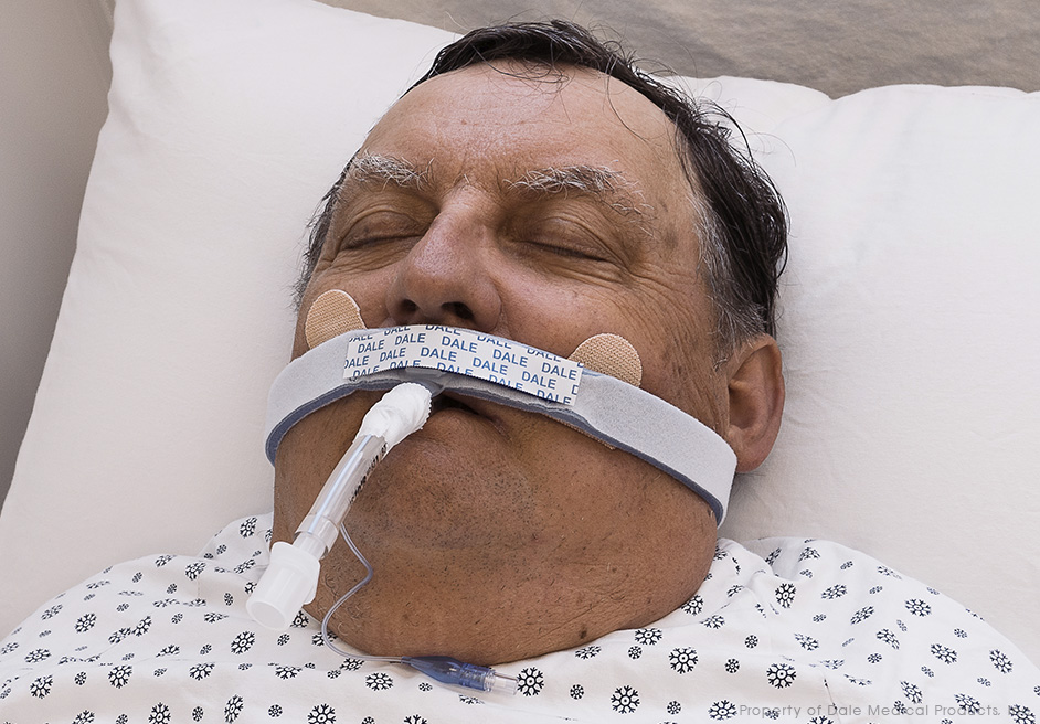 280 BreezeLock Endotracheal Tube Holder IFU Dale Medical Products