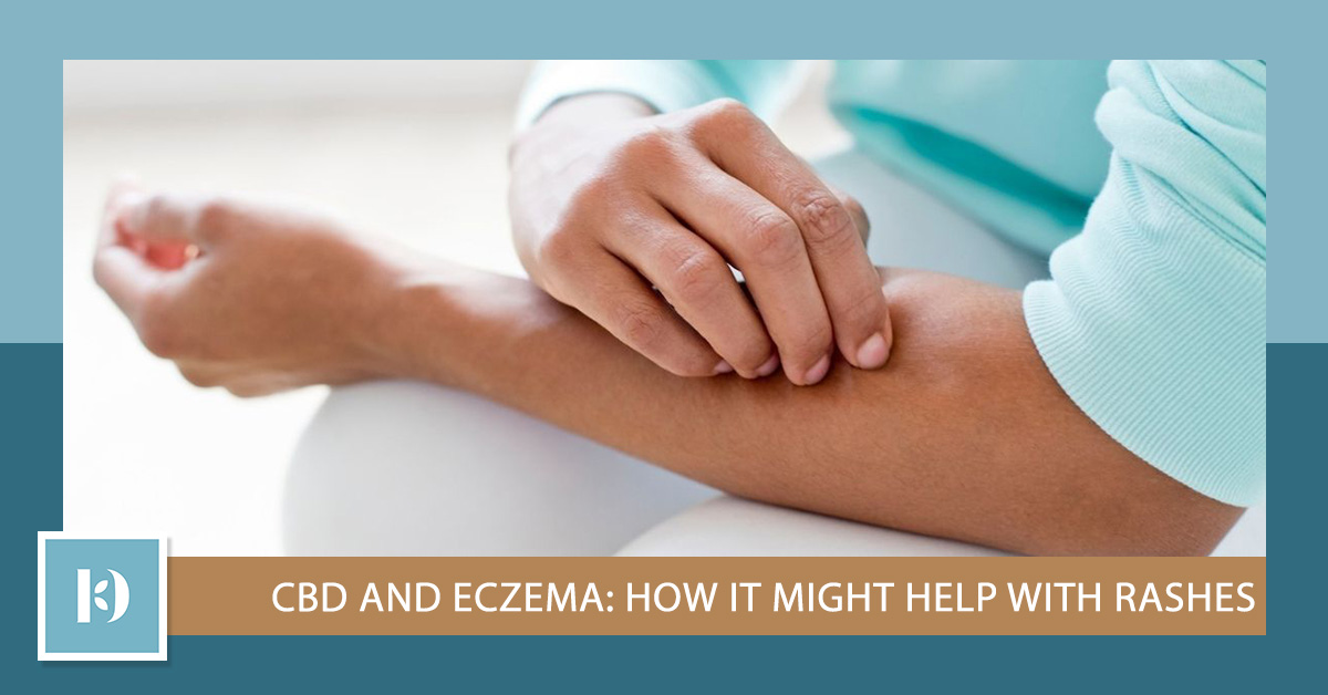 An image of a woman scratching her eczema.