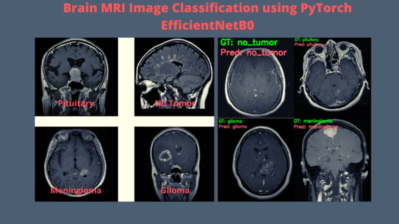 Brain Tumor Classification Using Pytorch Brain Tumor Mri Classification - Download Artistic Nature Illustration | 4K