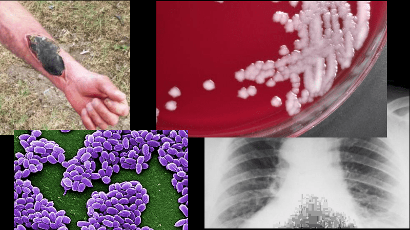 Sverdlovsk Anthrax Bioweapon Leak - Debunking Denialism