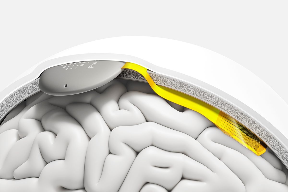 The Neuralink Puck