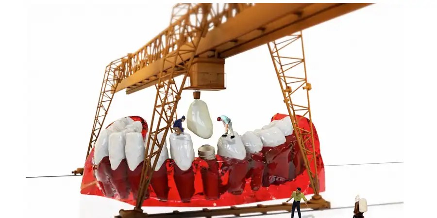 definition meaning of amalgam aluminium, meaning, synonym, antonym, use example and related words to amalgam