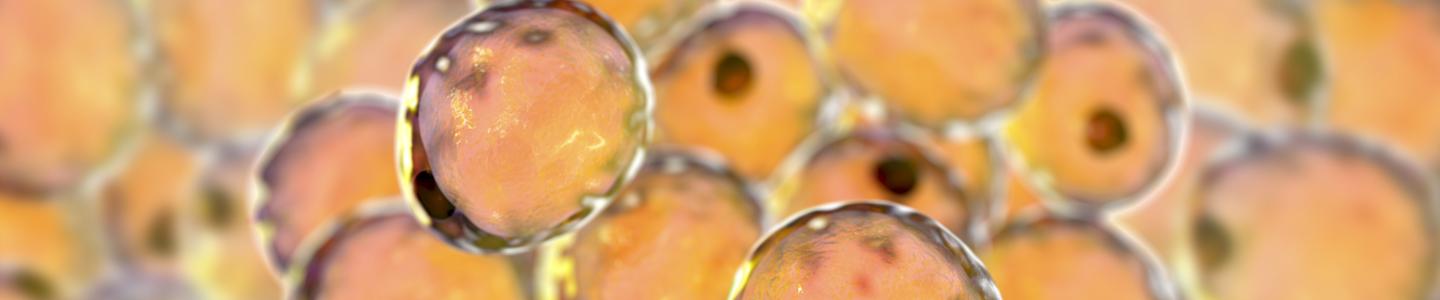 The Development Of A Standard In Vitro Model For Studying Metabolic Diseases | ATCC