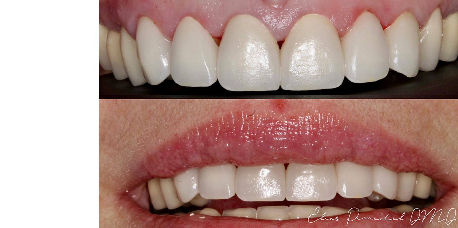 Refreshing a Smile With a New Design.