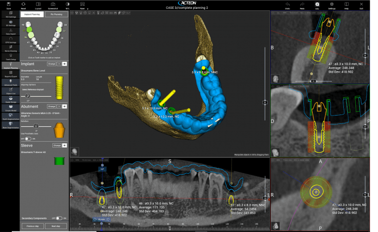 X-MIND Trium Pan CEPH 3D - Dentequip