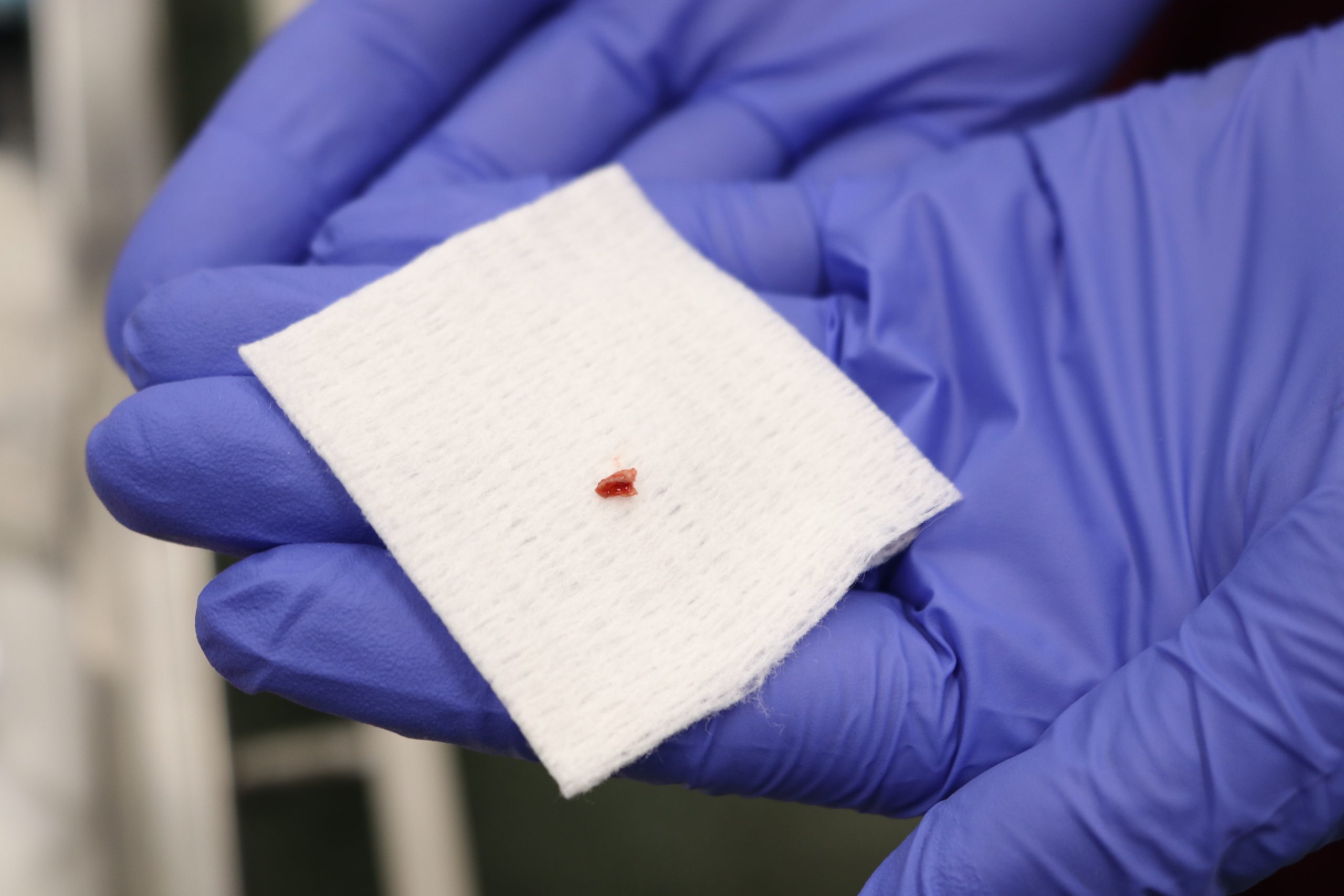 A tiny broken tooth fragment, removed from the gums of ernest the pygmy