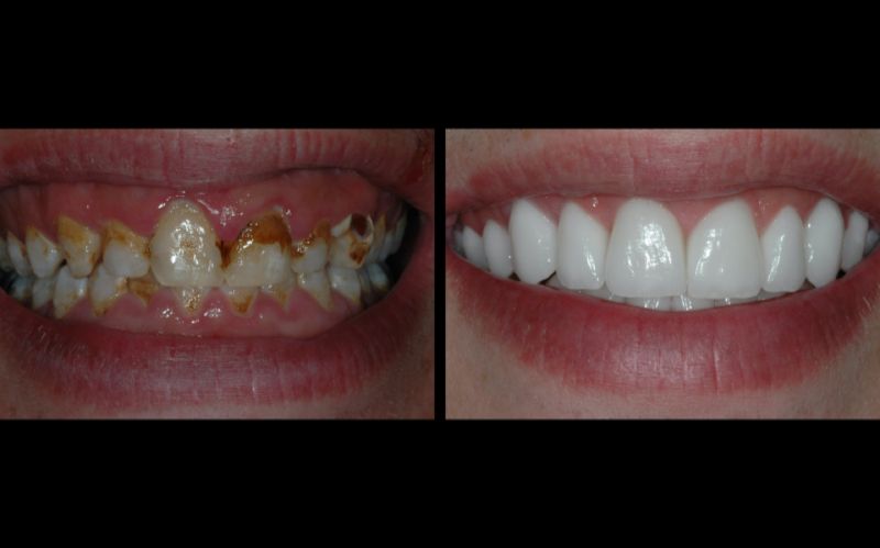 Youtube Dentistry Master Classes - Nature Photo Collection - 4K Quality