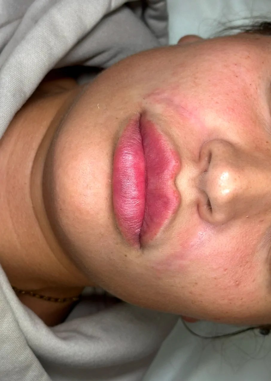 Dermalax Plus photo review