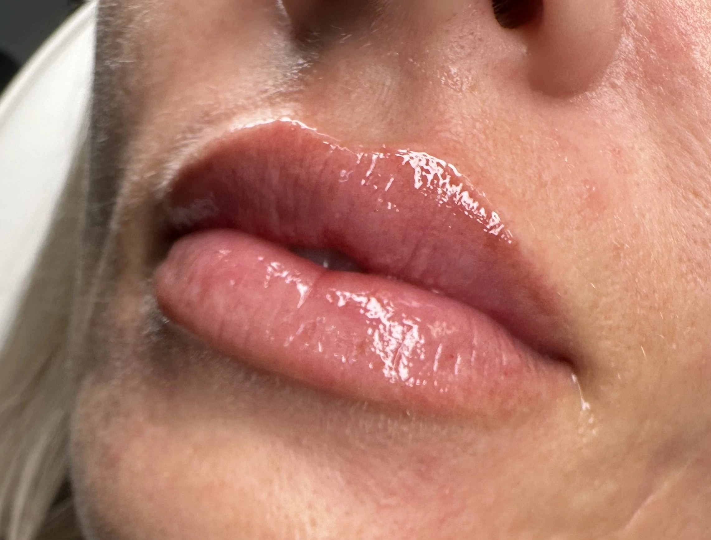 Revolax Deep photo review