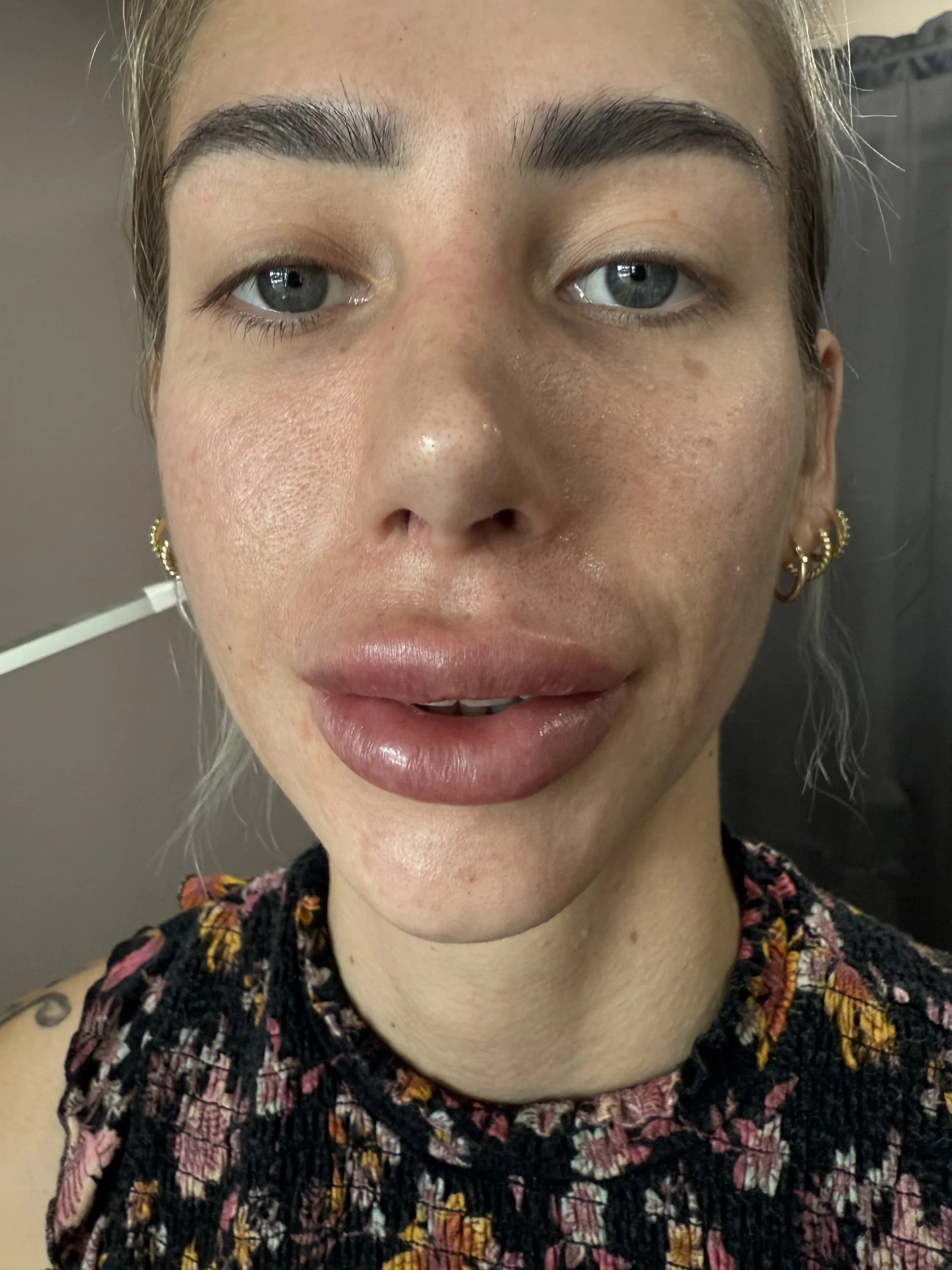 Revolax Deep photo review