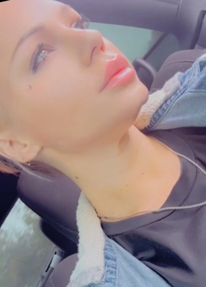 Celosome STRONG photo review