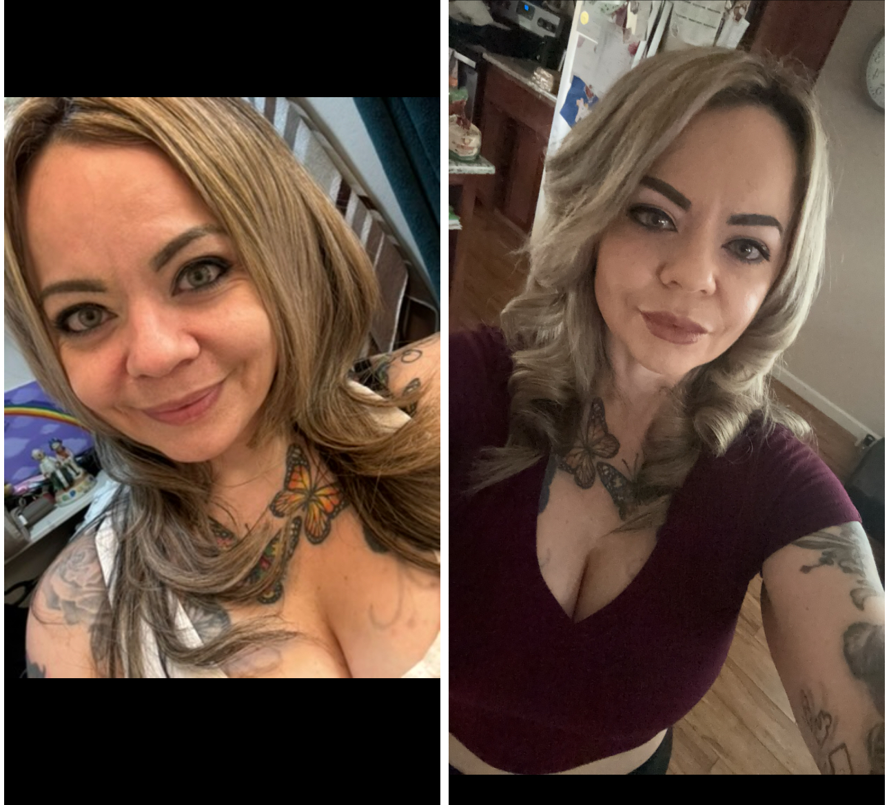 HyalDew MID with Lidocaine photo review