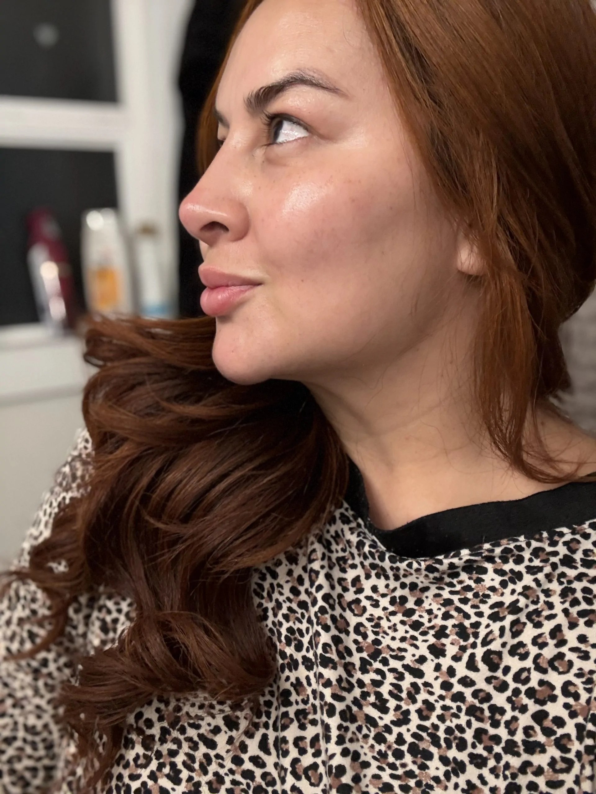 Celosome IMPLANT photo review