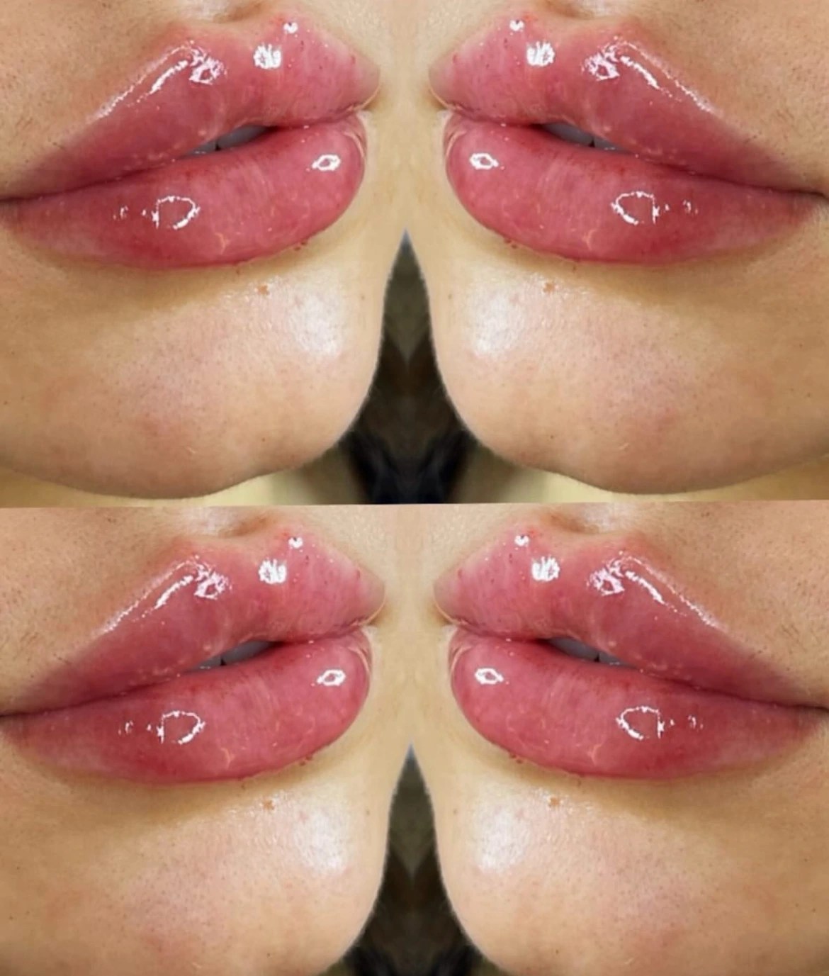 Celosome MID photo review