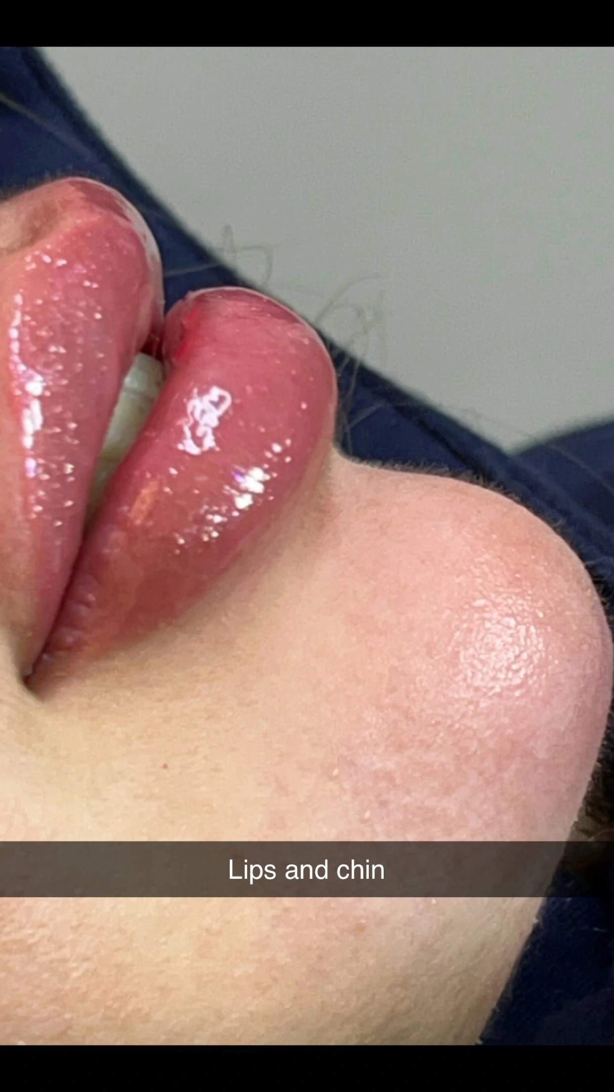 Celosome STRONG photo review