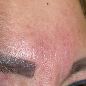 Celosome STRONG photo review