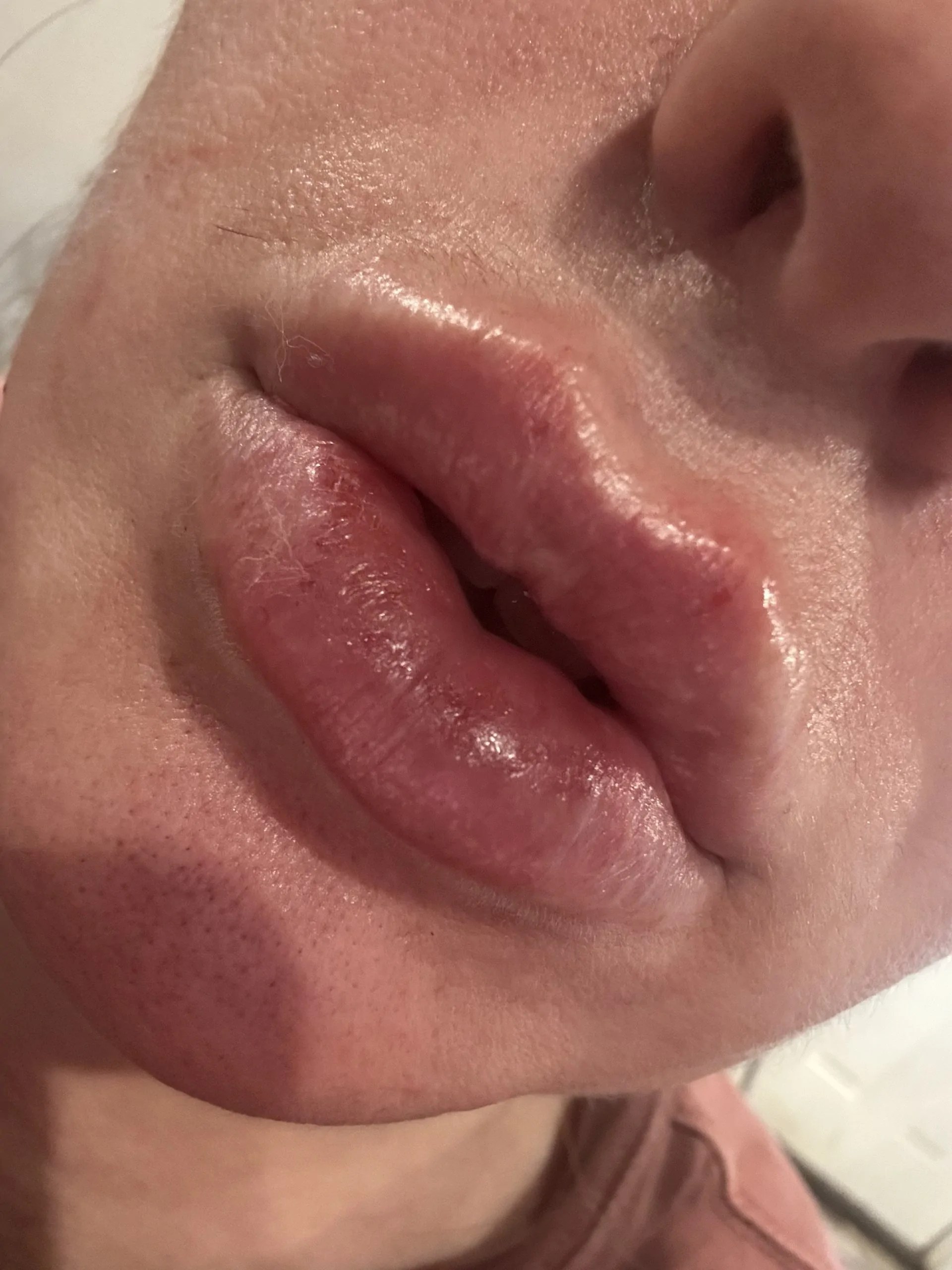 Celosome STRONG photo review