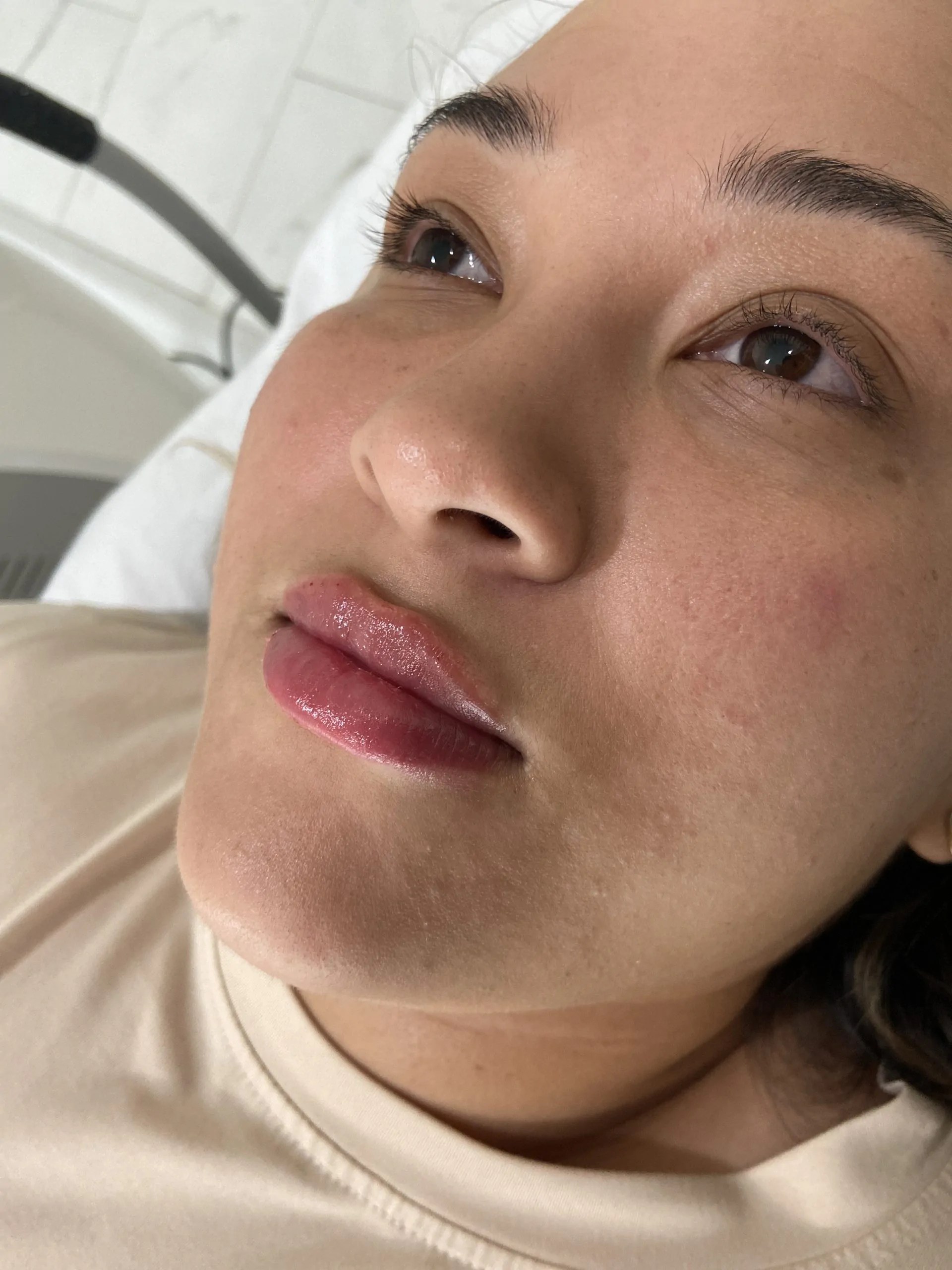 Revolax Deep photo review