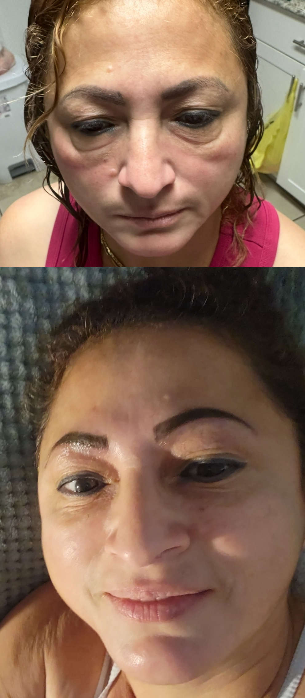 Replengen Fine photo review