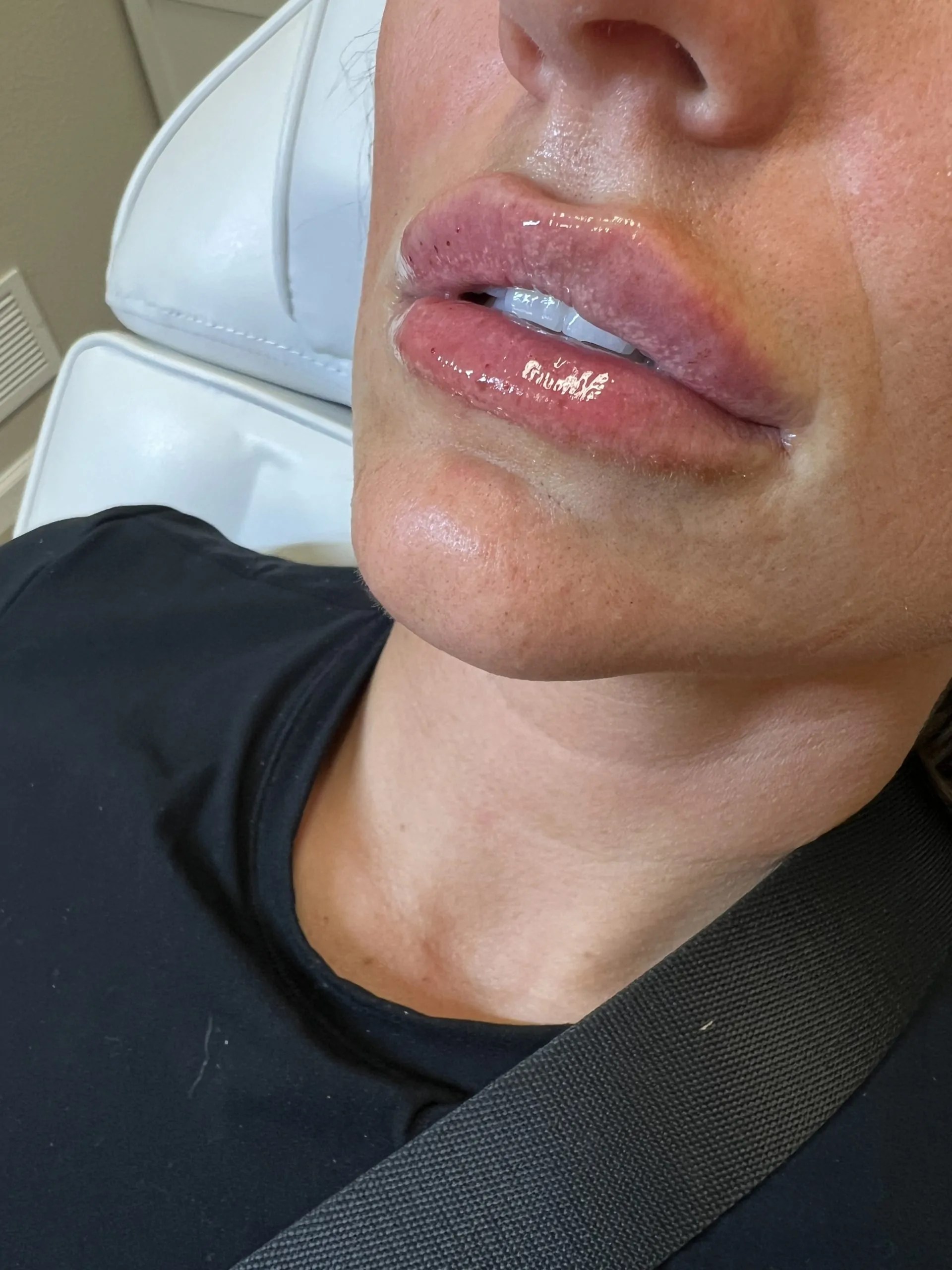 Revolax Deep photo review