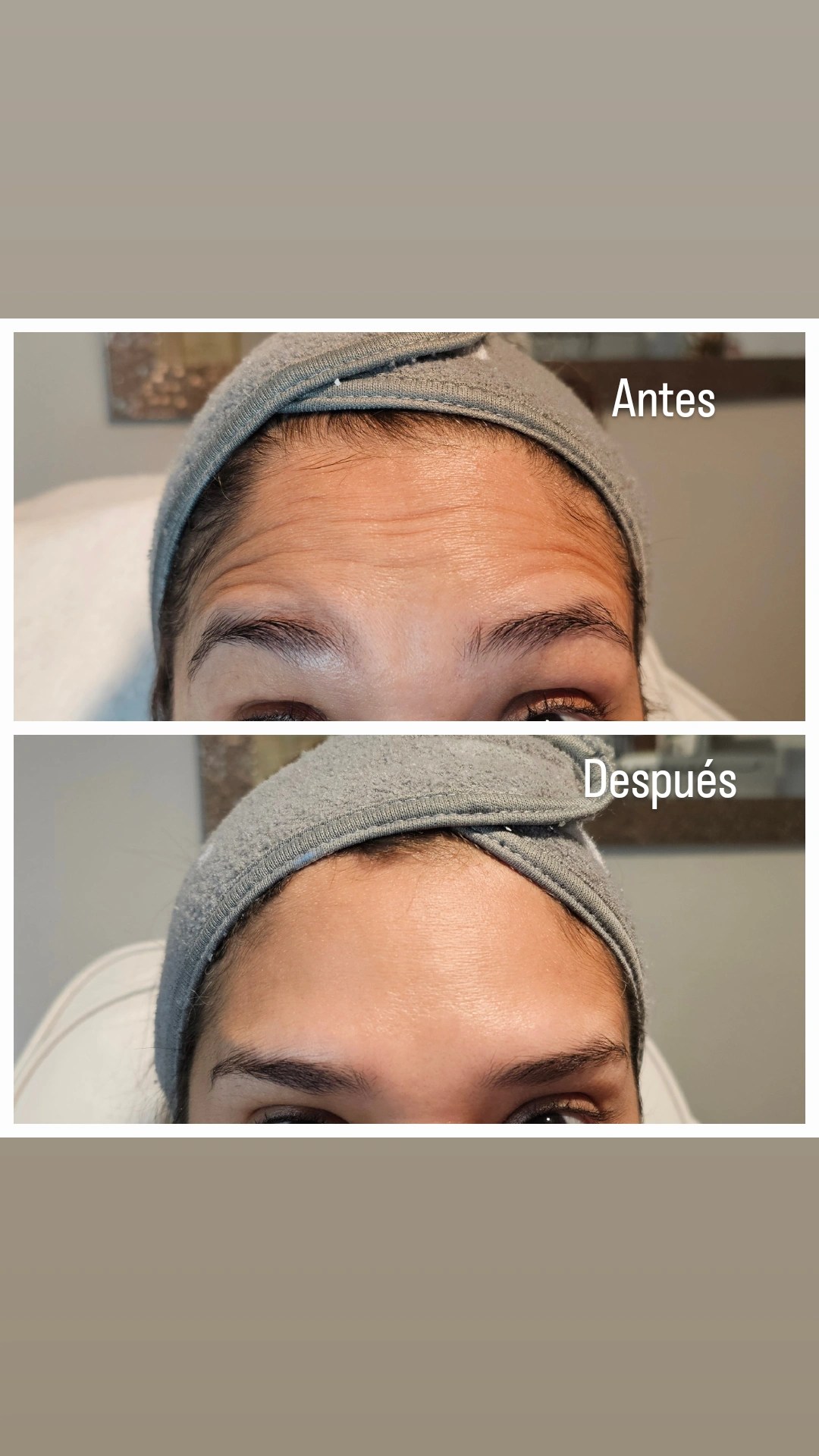 Nabota 100 Units photo review