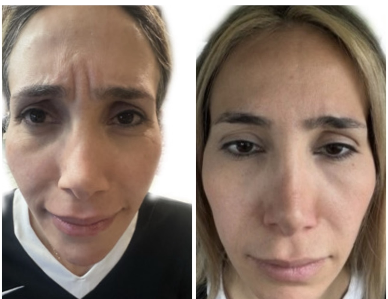 Nabota 100 Units photo review