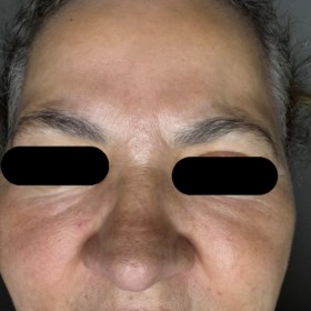 Curenex Rejuvenating Solution photo review