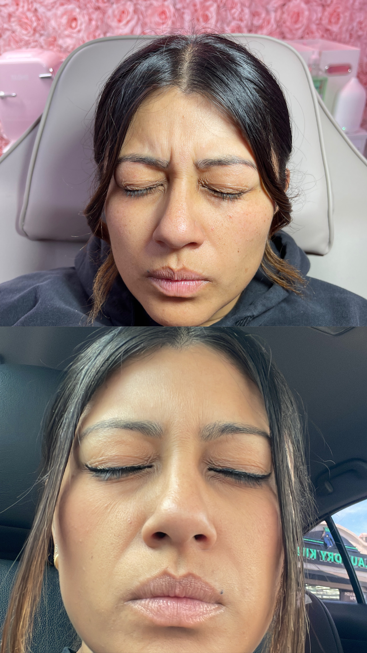 Nabota 100 Units photo review