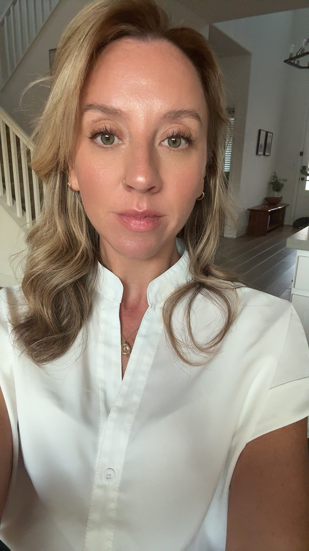 Innotox 100 Units photo review