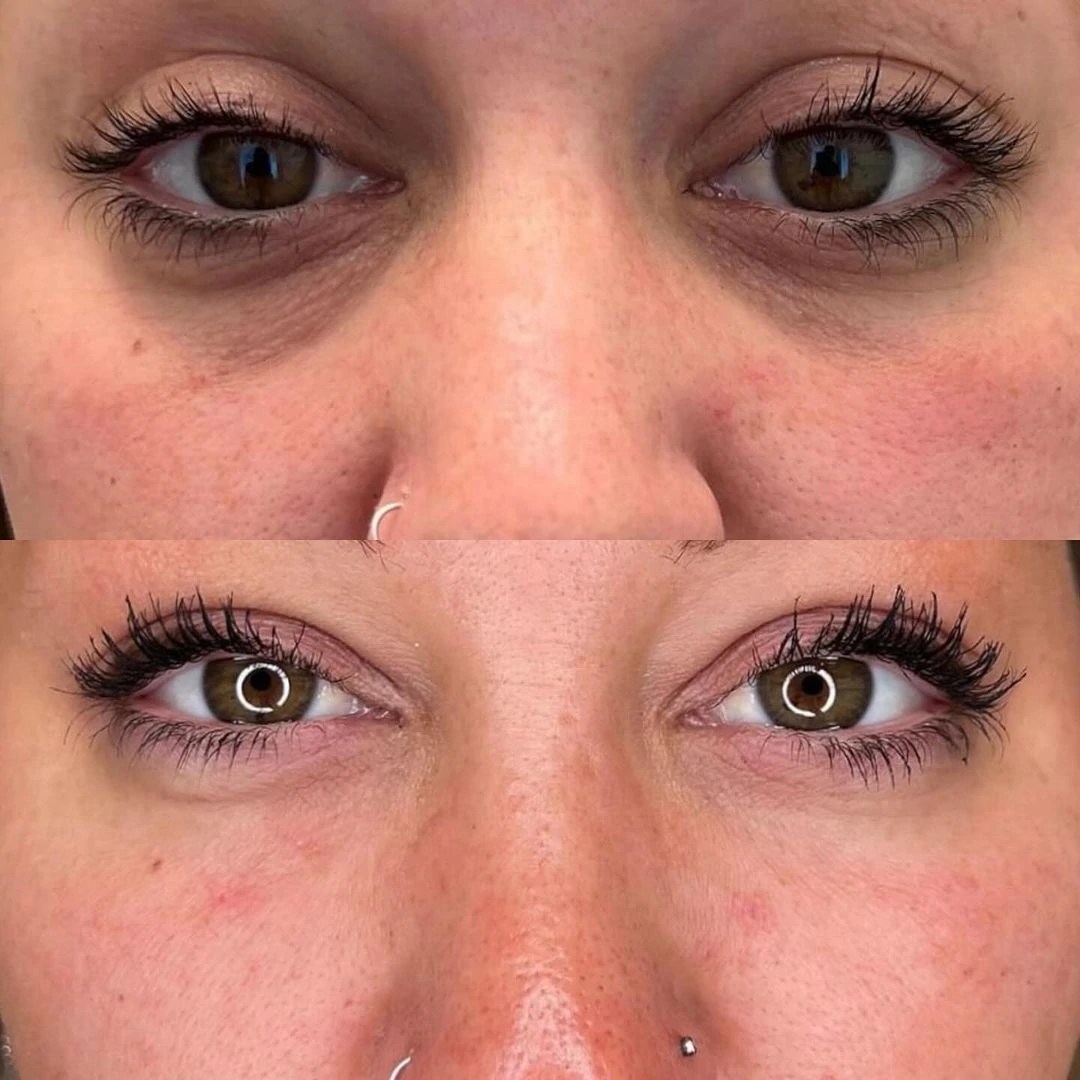 Juve Eyes photo review