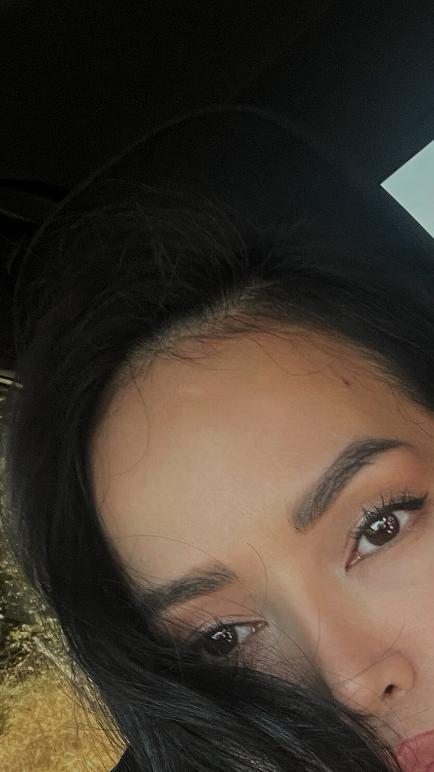 Metox 100 Units photo review