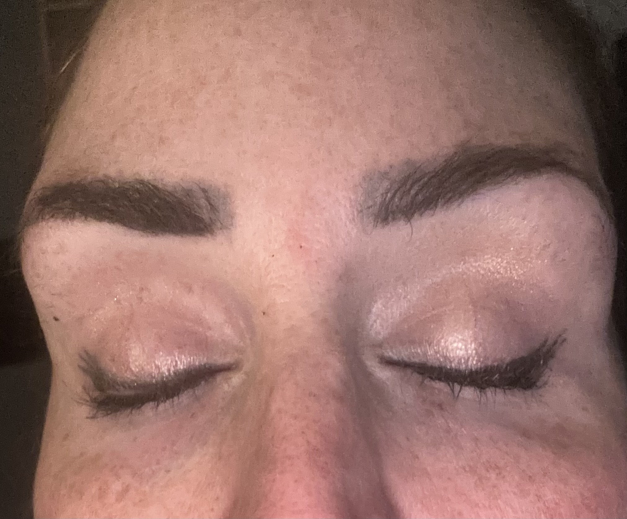 Metox 100 Units photo review