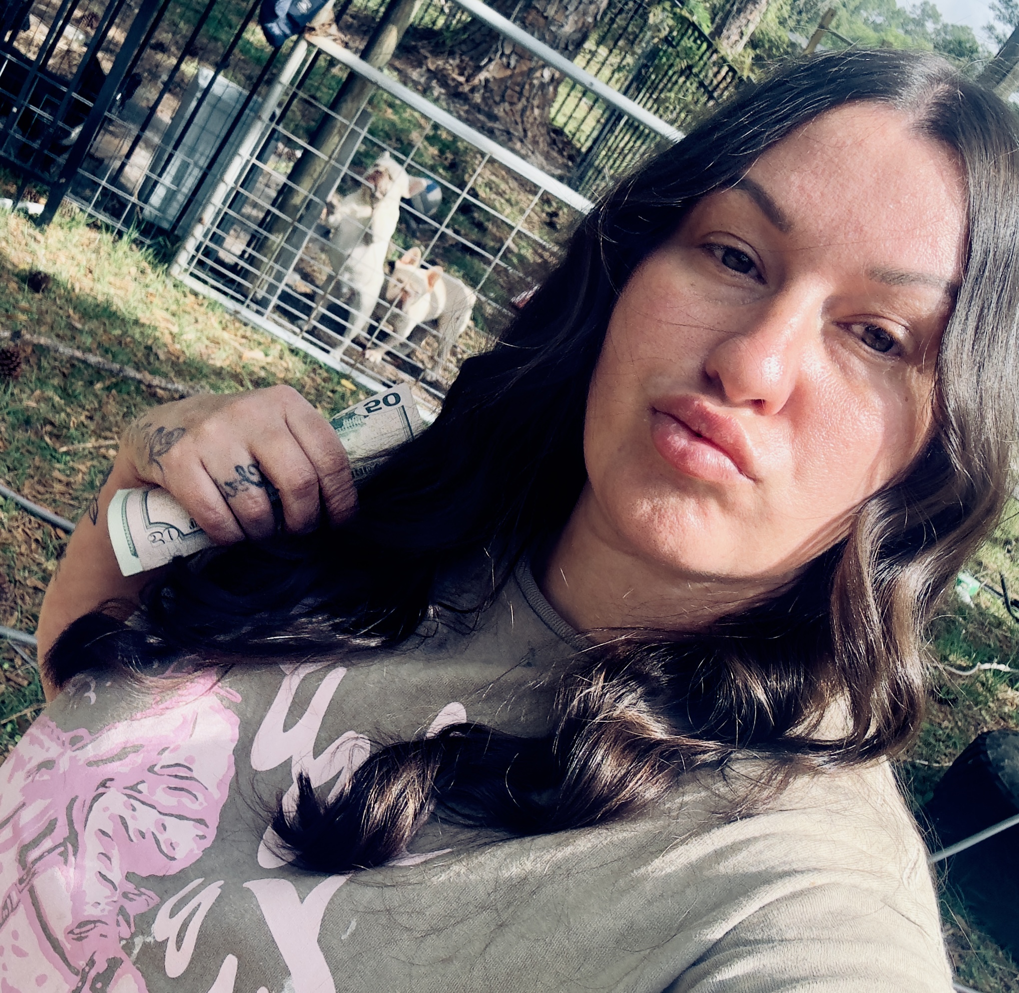 Metox 100 Units photo review