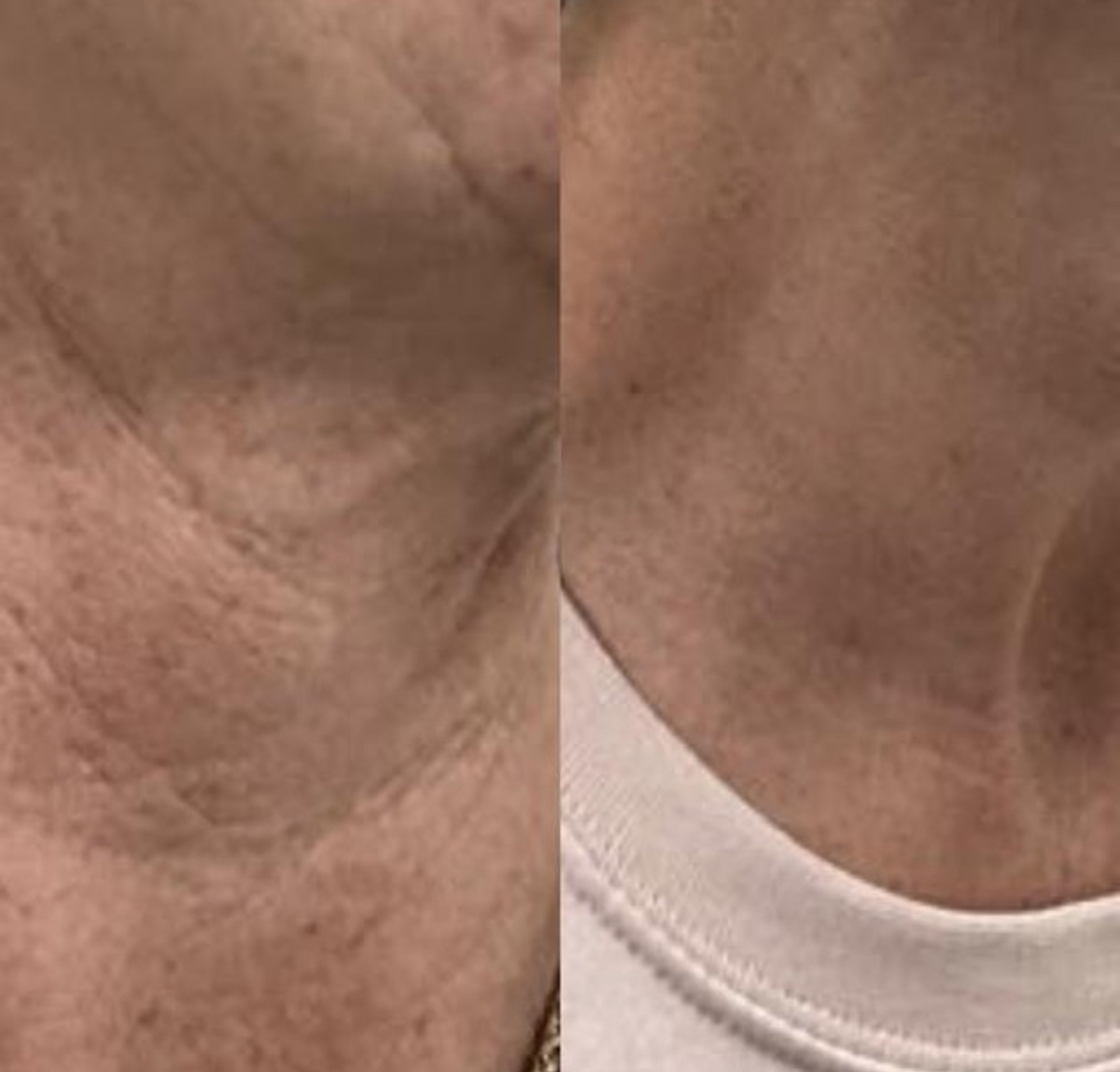 Bienox 100 units photo review