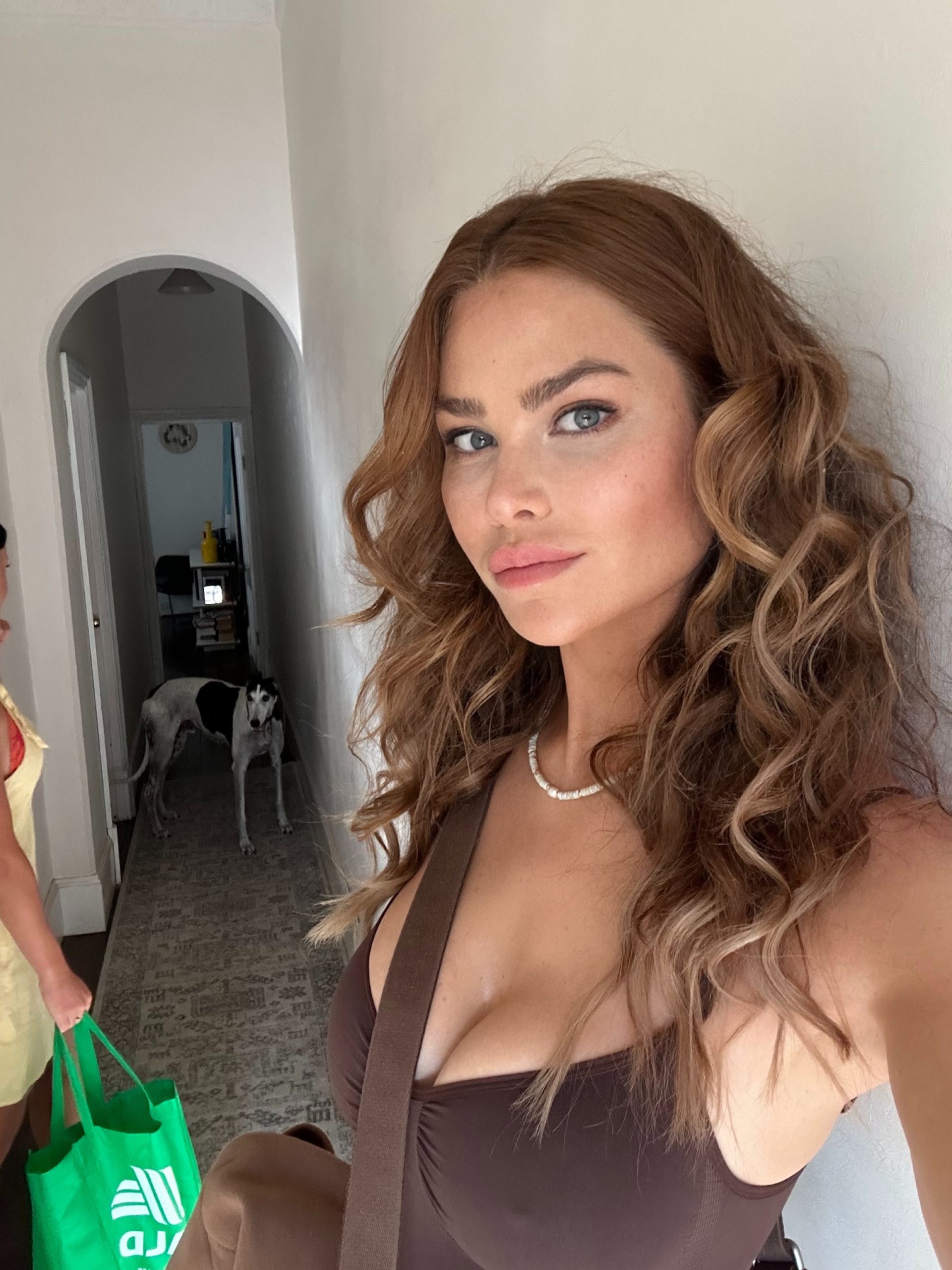 Botulax 300 Units photo review