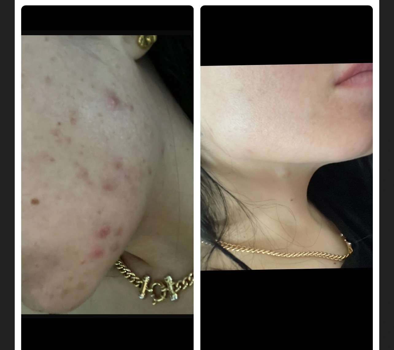 Juve Face photo review