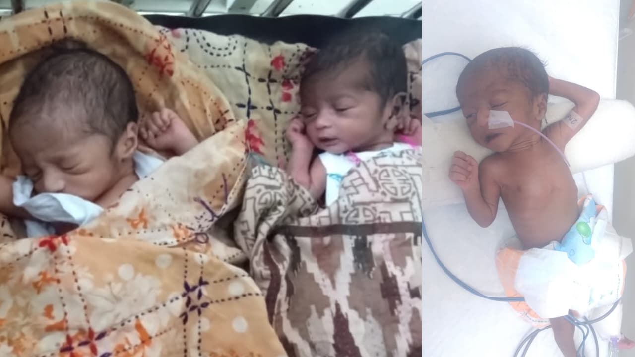 মিরসরাইয়ে সিজার ছাড়াই একসঙ্গে তিন সন্তানের জন্ম