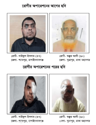 “চোখ বেঁচে থাক চোখের আলোয়”