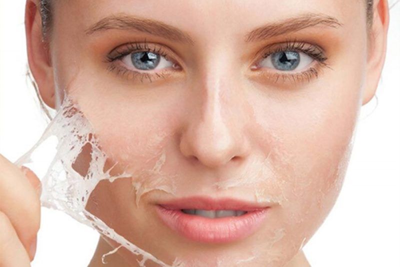 How To Treat Face Peeling