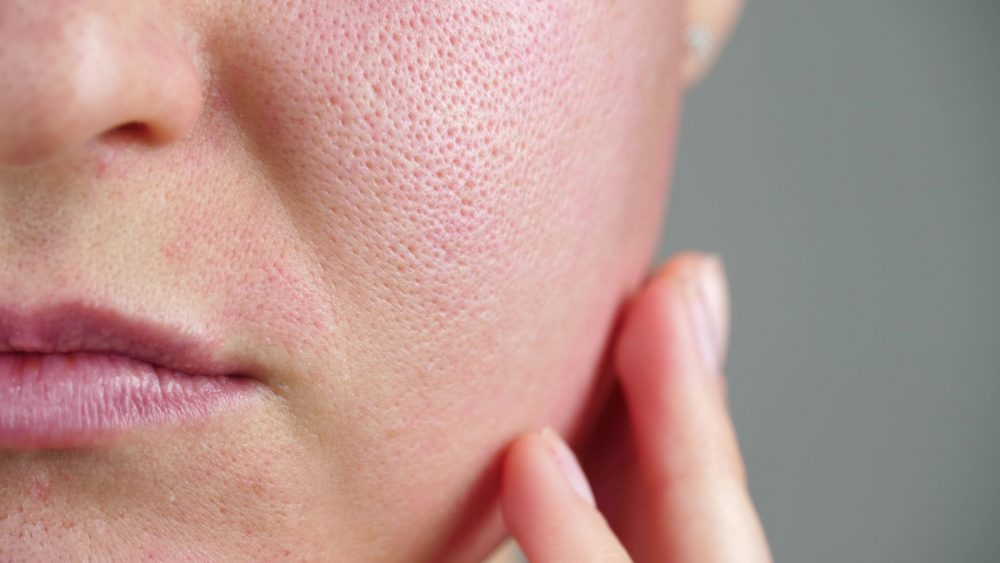 What You Should Know About Your Skin Barrier
