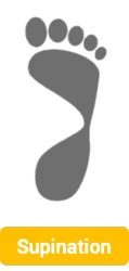 Supinated foot
