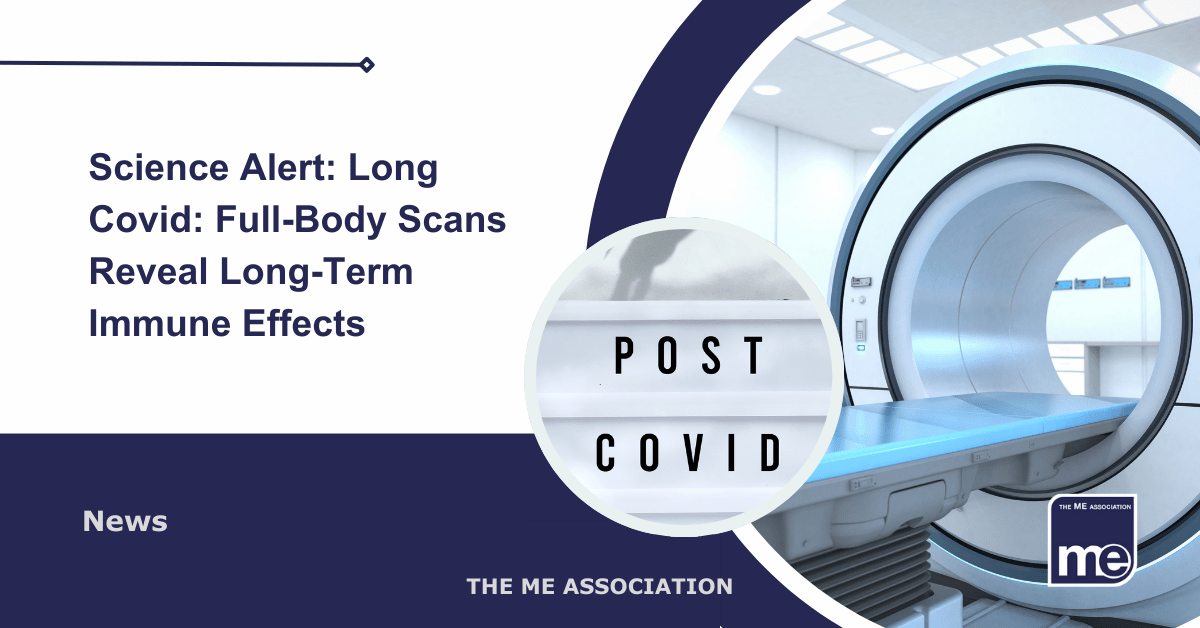 IMAGE DESCRIPTION: An image of a hospital scanner with a circular image of a light box saying 'Post Covid' i.e. Long Covid. The title reads: Science Alert: Full-Body Scans Reveal Long-Term Immune Effects. The ME Association Logo (bottom right)