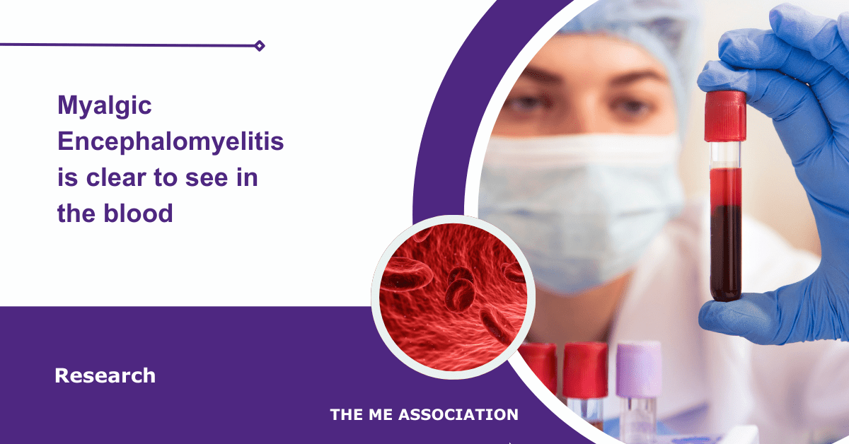 IMAGE DESCRIPTION: A person in a laboratory looking at a tube of blood and a circular image with blood and red blood cells. Title:Myalgic Encephalomyelitis is clear to see in the blood. The ME Association Logo (bottom right).