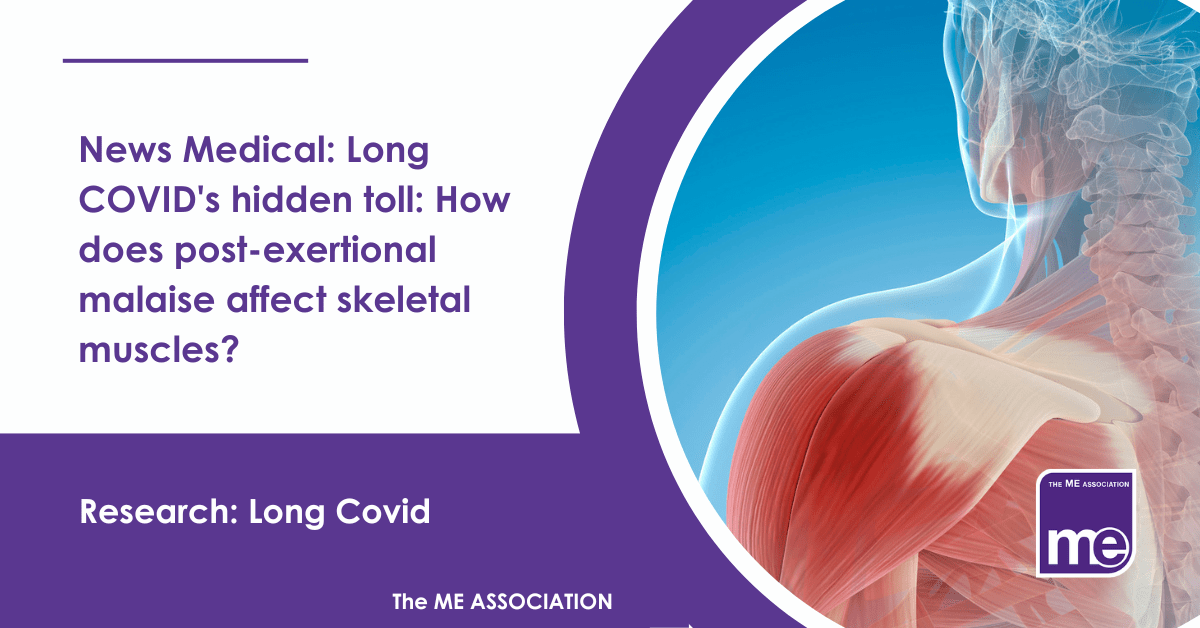 IMAGE DESCRIPTION: Am image of a skeleton showing muscles. Title reads: News Medical: Long COVID's hidden toll: How does post-exertional malaise affect skeletal muscles? The ME Association Logo (bottom right).