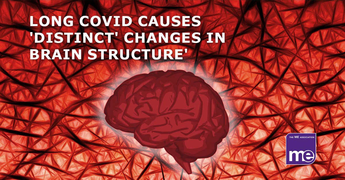 Research: Long Covid changes brain structure