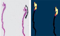 Predicting Aggressive Prostate Cancer With Ai Nvidia Technical Blog - Vintage Arts - Premium 8K Collection