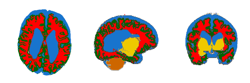 Multiplex Annotated Tissue Imaging System Mantis Microscopy Focus - Premium Vintage Pattern Gallery - Mobile
