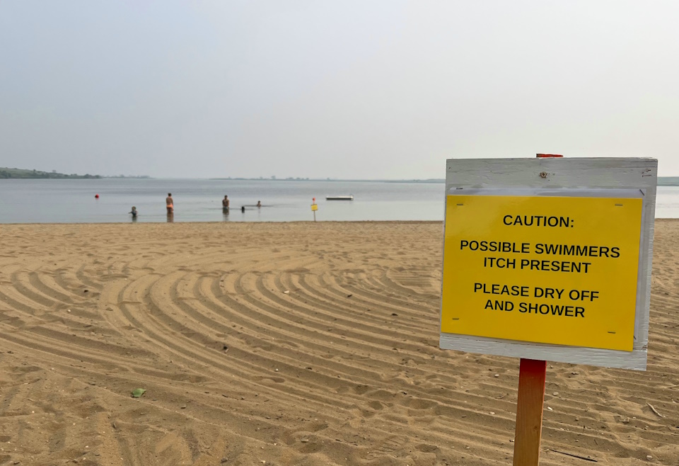 How to Avoid Swimmer's Itch: Tips for a Rash-Free Summer (2026)