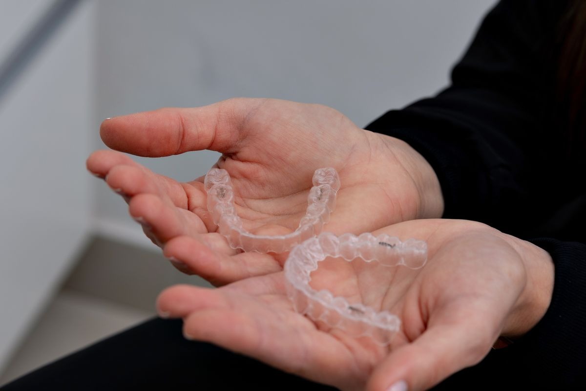 How Clear Aligners Compare to Traditional Braces for Adults